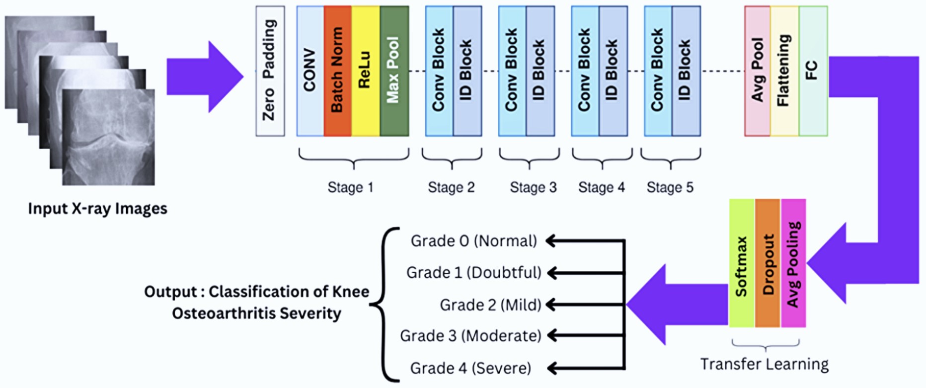 Knee Osteoporosis detection using deep learning