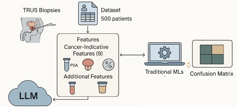 Prostate cancer detection using LLM