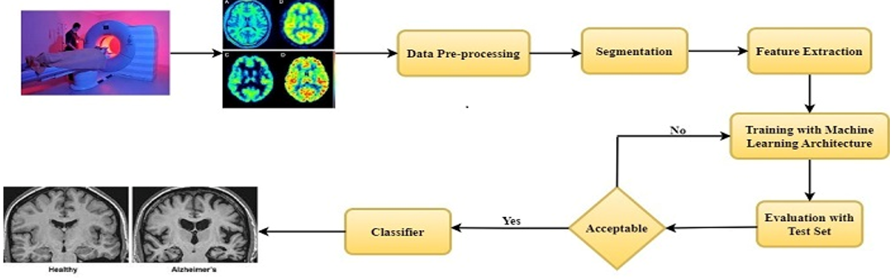 Alzeihmer's disease detection using machine learning