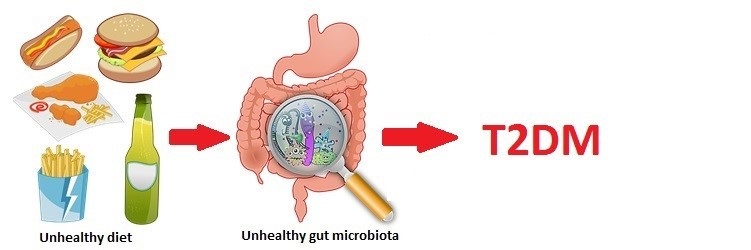 gut microbiota and diabetes